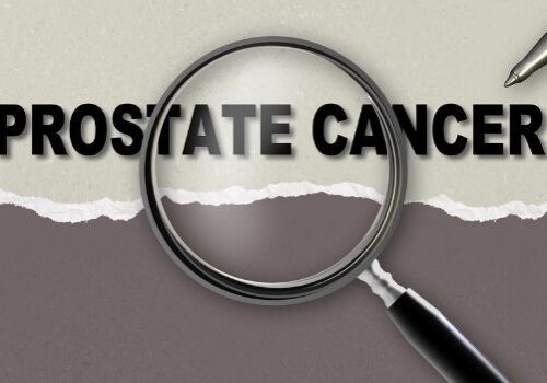 quick-guide-to-prostate-cancer